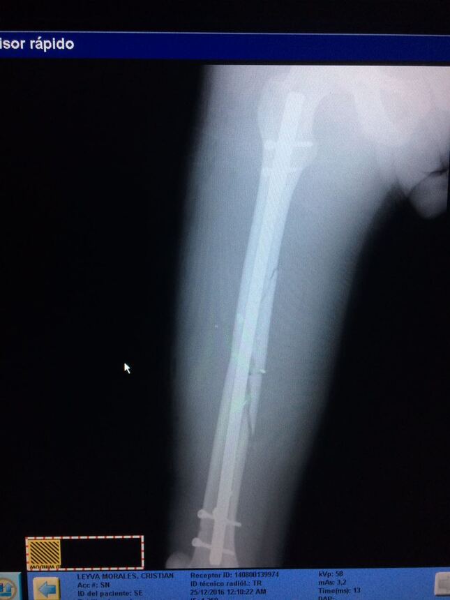 Traumatología en Villahermosa, Tabasco