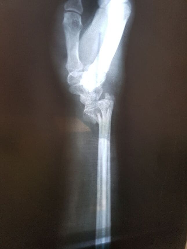 Ortopedia en Villahermosa