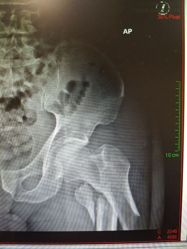 Traumatólogo en Villahermosa