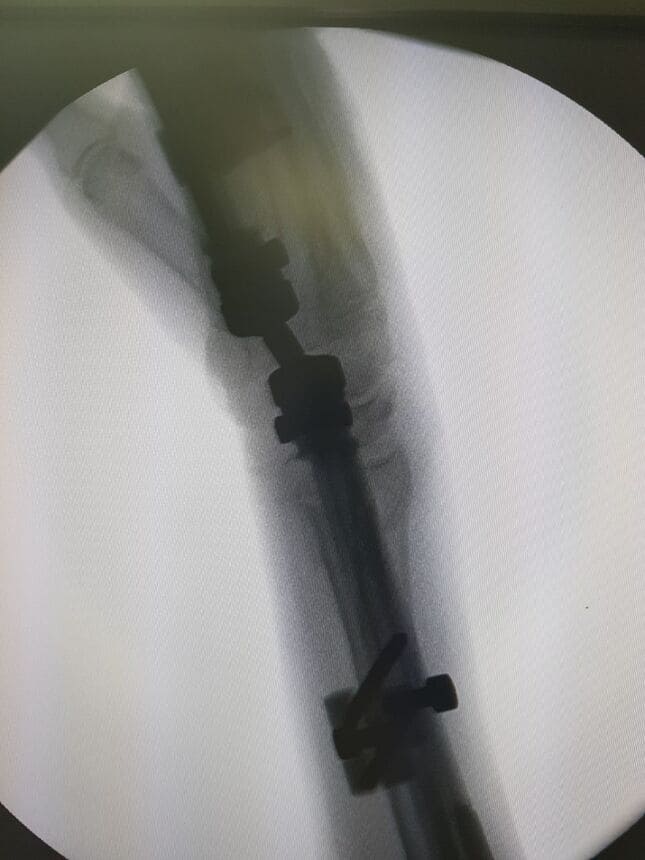 Traumatólogo Ortopedista en Villahermosa