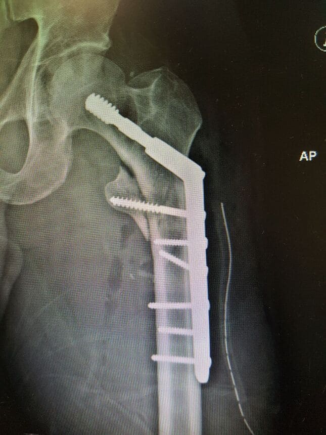 Médico Traumatólogo en Villahermosa