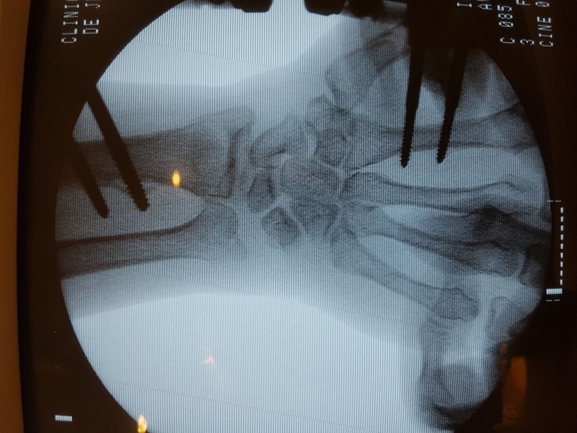 Traumatólogo en Villahermosa, Tabasco