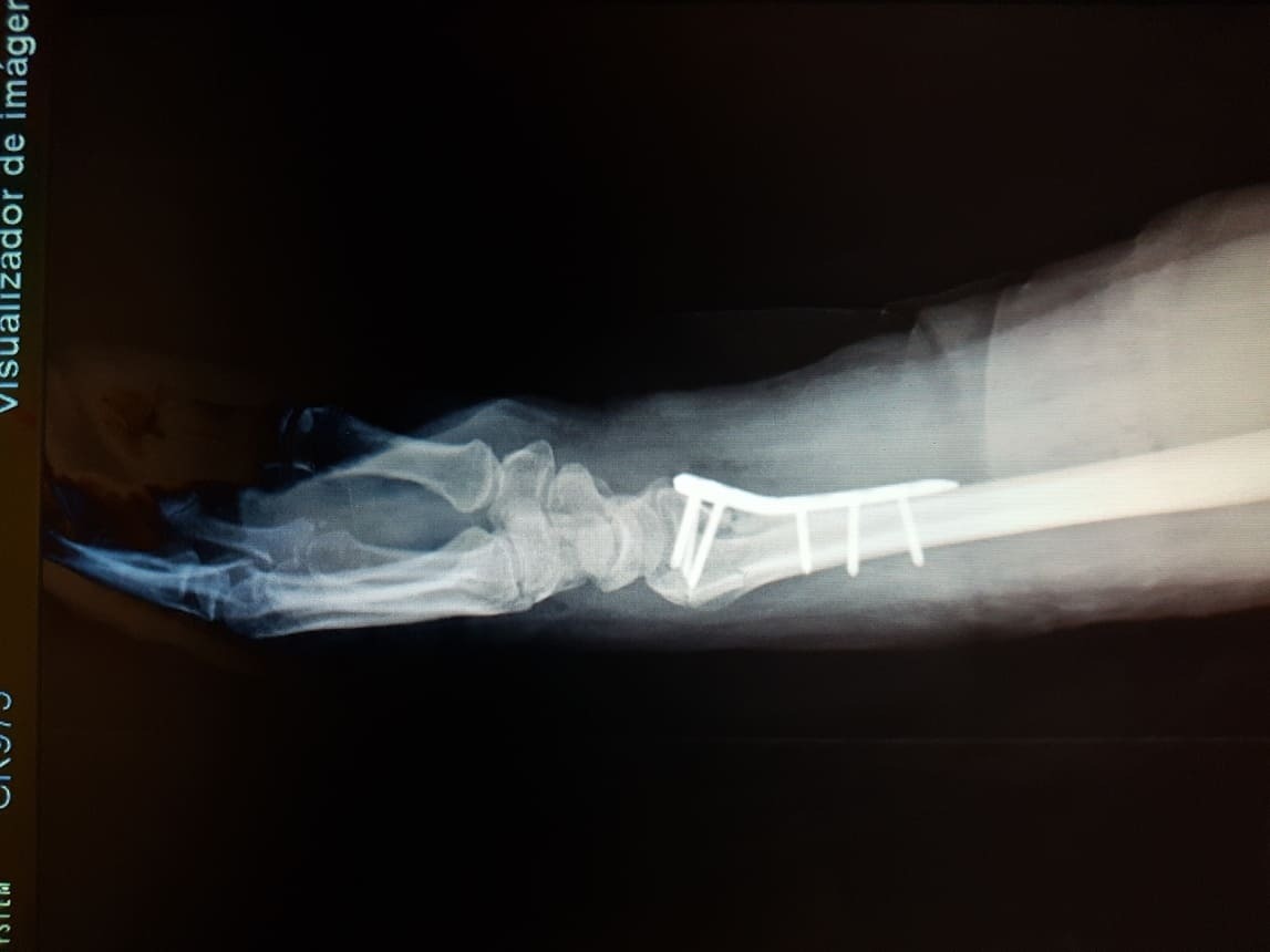 Traumatología en Villahermosa